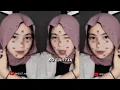 Download Lagu PRESET ALIGHT MOTION🎟️|| FOTO KAMU📸|| DI BAWAH 5MB + XML💌|| SOK CANTIK, EMANG GUE CANTIK🎶💥