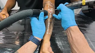 A tinta dessa tatuagem quase DESTRUIU a lente do meu laser de R$400 mil! 😳| Remoção de Tatuagem