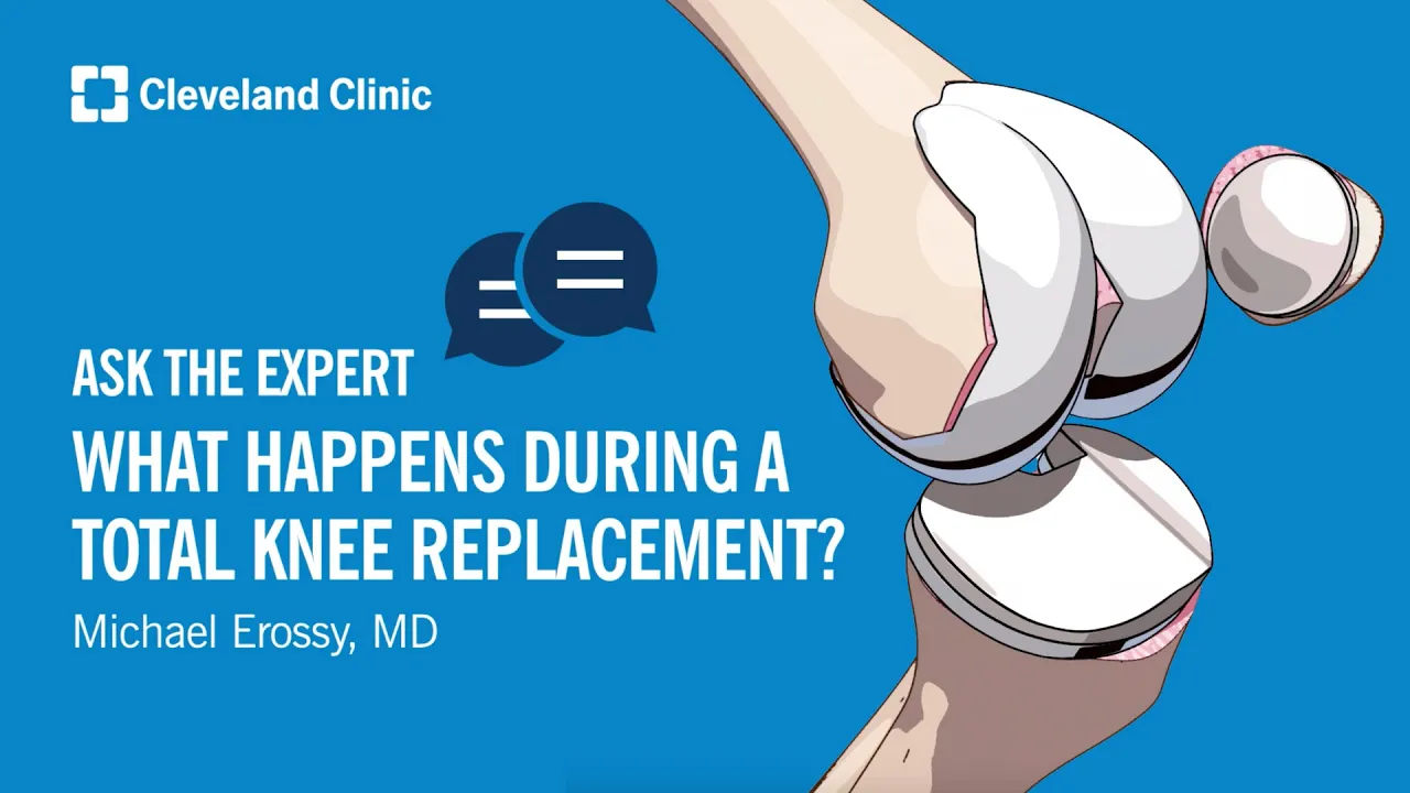 What Happens During a Total Knee Replacement? | Ask Cleveland Clinic's Expert