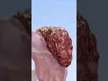 Download Lagu Liver Cirrhosis The Silent Killer You Need to Know About 3D visualization with VOKA Anatomy Pro