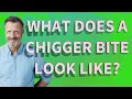 What does a chigger bite look like