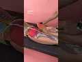 Sciatic Nerve Massage Back pain radiating to the legs To heal by physiotherapy