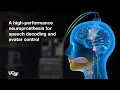 A Neuroprosthesis for Speech Decoding and Avatar Control Chang Lab - UCSF