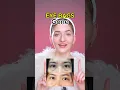 Eye bags gone naturally