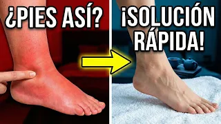 ¿Pies y Tobillos Hinchados por Retención de Líquidos? Este Remedio Natural SÍ Funciona