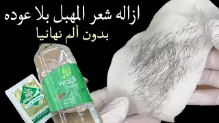 With Vinegar And Baking Powder You Will Get Rid Of Excess Hair From The Roots And Painlessly 