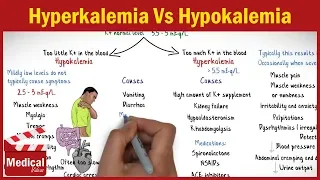 Hyperkalemia Vs Hypokalemia EASY TO REMEMBER