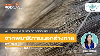 เห็บหมัดสามารถนำโรคติดต่อคนได้หรือไม่