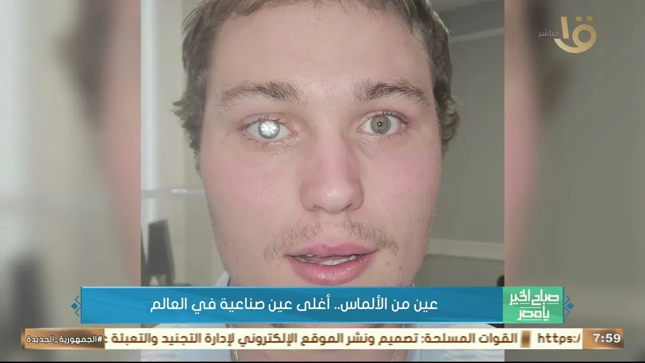 عين من الألماس.. أغلى عين صناعية في العالم