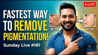 Fastest way to remove Pigmentation. Sunday Live #181