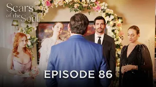Scars Of The Soul Episode 86 Alaca English Subtitles 