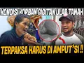 KISAH PAK YAYAT KORBAN GIGITAN ULAR VIPER TANAH YANG AKHIRNYA HARUS DI AMPUT4SI !!