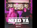 Need Ya (I Don't Wanna) (Acoustic Version)