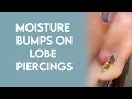 Moisture Irritation Bumps on Ear Piercings