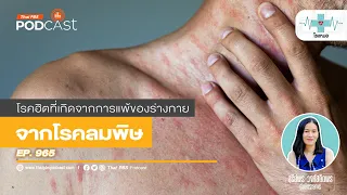 ลมพิษเรื้อรังมีสาเหตุจากอะไรบ้าง