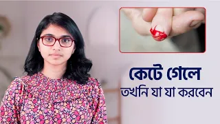 কেটে গেলে তখনি যা যা করবেন — ডা. তাসনিম জারা (চিকিৎসক, ইংল্যান্ড)
