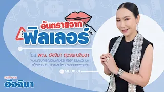 ฟิลเลอร์คืออะไร และมีประเภทไหนบ้างที่ใช้กันทั่วไป