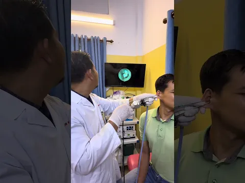 😱 Impacted Earwax Carefully Removed From the Ear Canal! #earwax #earcare #shorts