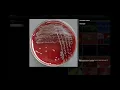 Bacterial Fluorescence Under UV Light - Microbiology