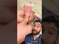 Doctor Explains Foot Tickle Sign