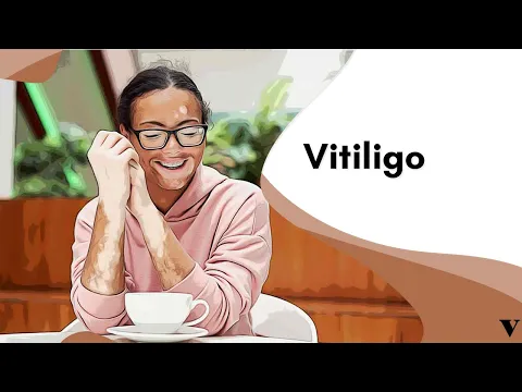 Download MP3 Quais os Tipos de Vitiligo? Veja as Causas e Riscos