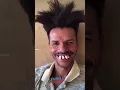 Biggest Teeth in The World