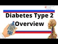 Diabetes mellitus type 2 - definition types risk factors causes symptoms diagnosis treatment