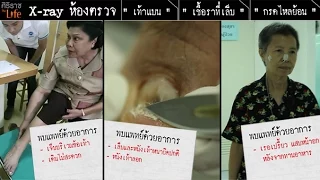โรคกรดไหลย้อนเกิดจากอะไร และมีอาการอย่างไร