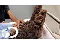 Download Lagu My Shocking Story: Treeman the Cure - Hospital Life