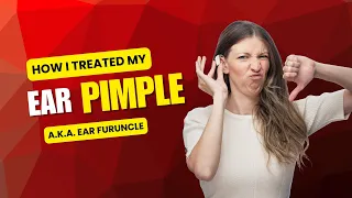 I Got an Ear Pimple and It Was Unbearably Painful Here s What Happened