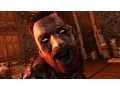 IRIS GREATEST FEAR The Witcher 3 Hearts of Stone No Quen
