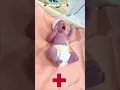 Download Lagu new born baby normal delivery pregnant#emostional#newbornbaby#mom#love#babycare@DrSkm108