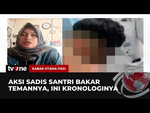 Santri Asal Aceh Tengah Dibakar Teman Satu Ponpes