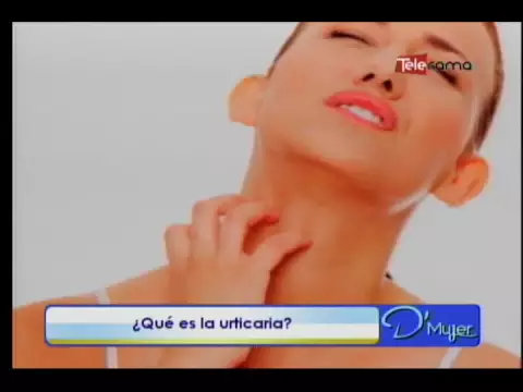 Qué es la urticaria