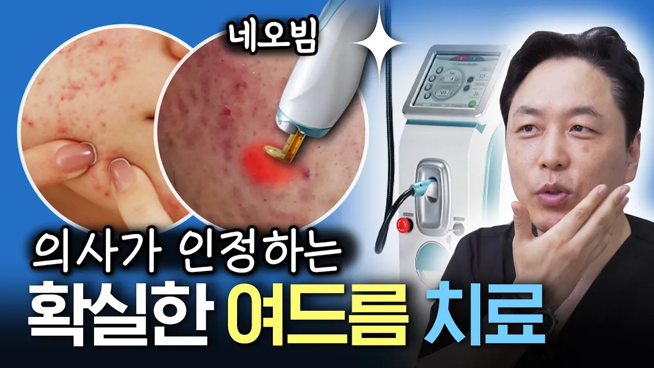 네오빔으로 지긋지긋한 여드름 탈출하세요!