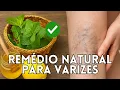 Download Lagu Acabe com as varizes e má circulação! Tratamento natural incrível 🌿