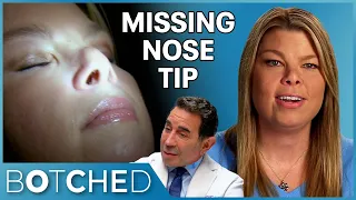 Mellissa Was Bullied For Her Nose and Her Nose Job Made Her Self-Esteem WORSE | Botched | E!