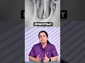 Stitches after vaginal delivery