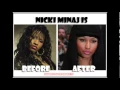 Shocking Nicki Minaj Before Plastic Surgery