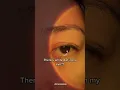 Download Lagu There’s white dot in my eye?? #shorts #viral #whitedot