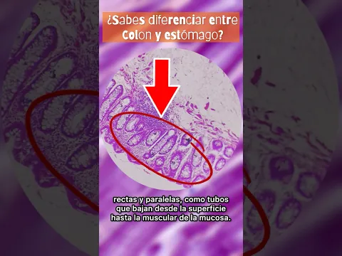 Colon vs Estómago, explicación sencilla #histología #yosoydelos7mil #medicina #medicine