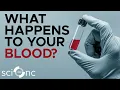 What Happens to Your Blood Test