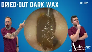 Dried-Out Dark Wax That Wouldn't Budge – Until the Oil Went In – EP1327