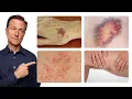 The Deeper Causes of BRUISING Non-Injury Type