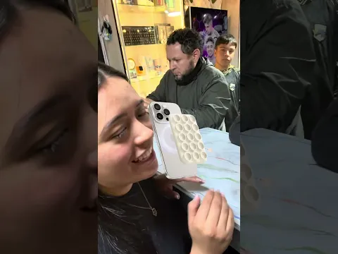 Primera vez que veo un caso de estos 😳