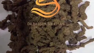 ما هو الناردين Valerian 