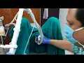 Vaginal Tightening Procedure | Dr Sham Sunder Goyal MBBS MD