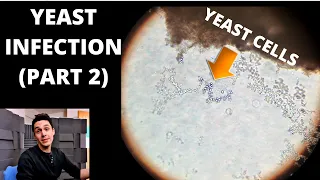 Yeast Infection Under The Microscope Part 2 