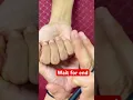 Lucky person you have mole in hand