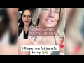 Regrets After Fat Transfer to The Breasts